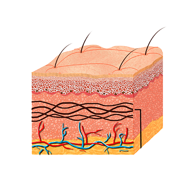 Depois - Pele Restaurada